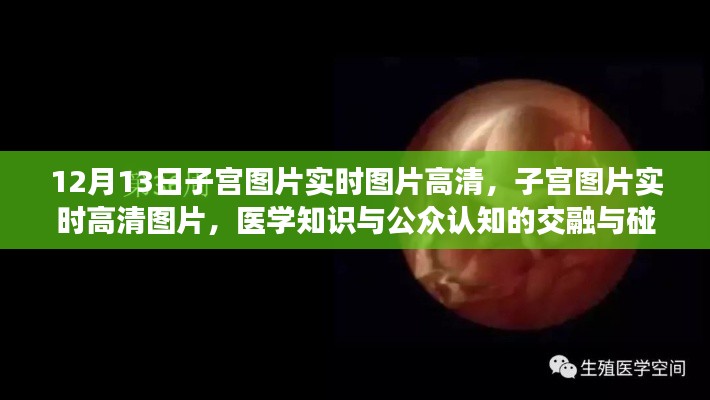 醫(yī)學知識與公眾認知交融，高清子宮圖片實時展示與探討