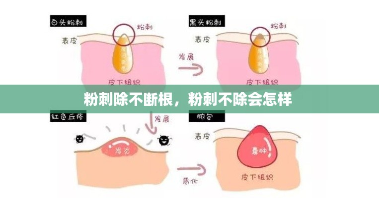 粉刺除不斷根，粉刺不除會(huì)怎樣 