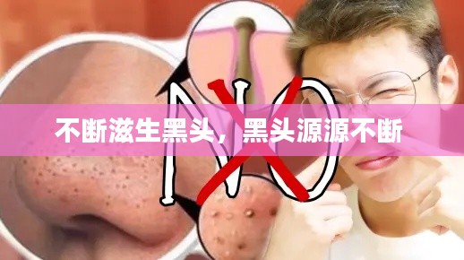 不斷滋生黑頭，黑頭源源不斷 