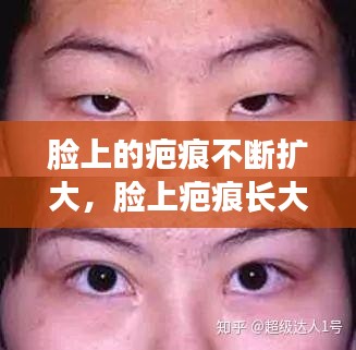 臉上的疤痕不斷擴(kuò)大，臉上疤痕長大能變淡嗎 
