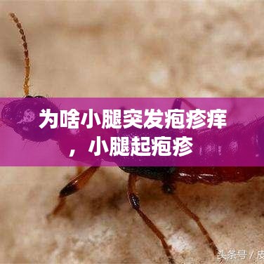 為啥小腿突發(fā)皰疹癢，小腿起皰疹 