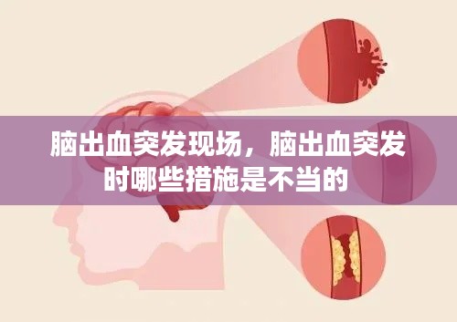 腦出血突發(fā)現(xiàn)場(chǎng)，腦出血突發(fā)時(shí)哪些措施是不當(dāng)?shù)?