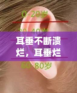 耳垂不斷潰爛，耳垂爛了怎么回事 