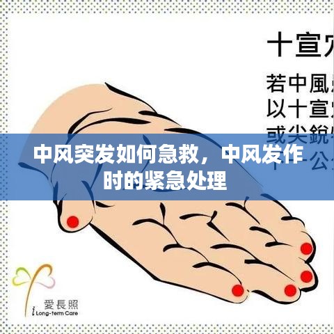 中風(fēng)突發(fā)如何急救，中風(fēng)發(fā)作時(shí)的緊急處理 