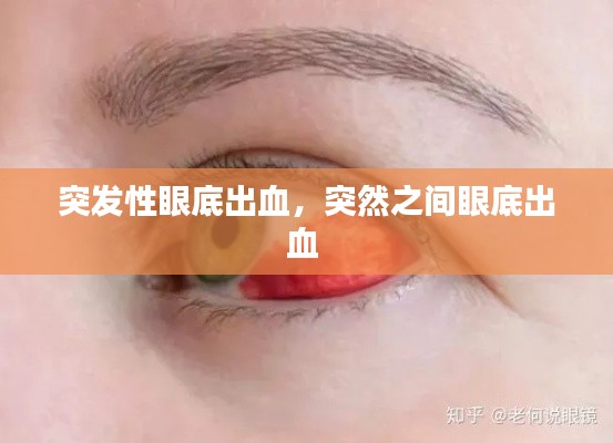 突發(fā)性眼底出血，突然之間眼底出血 