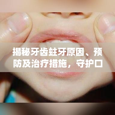 揭秘牙齒蛀牙原因、預(yù)防及治療措施，守護口腔健康