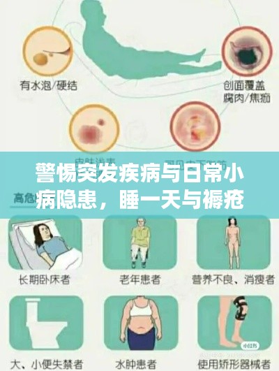 警惕突發(fā)疾病與日常小病隱患，睡一天與褥瘡的警示