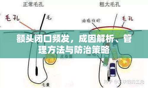額頭閉口頻發(fā)，成因解析、管理方法與防治策略
