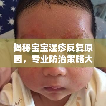 揭秘寶寶濕疹反復(fù)原因，專業(yè)防治策略大解析！