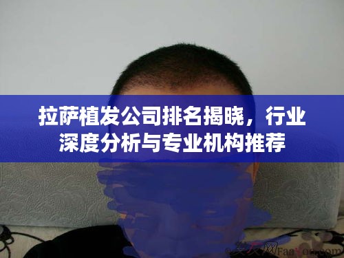 拉薩植發(fā)公司排名揭曉，行業(yè)深度分析與專業(yè)機構(gòu)推薦